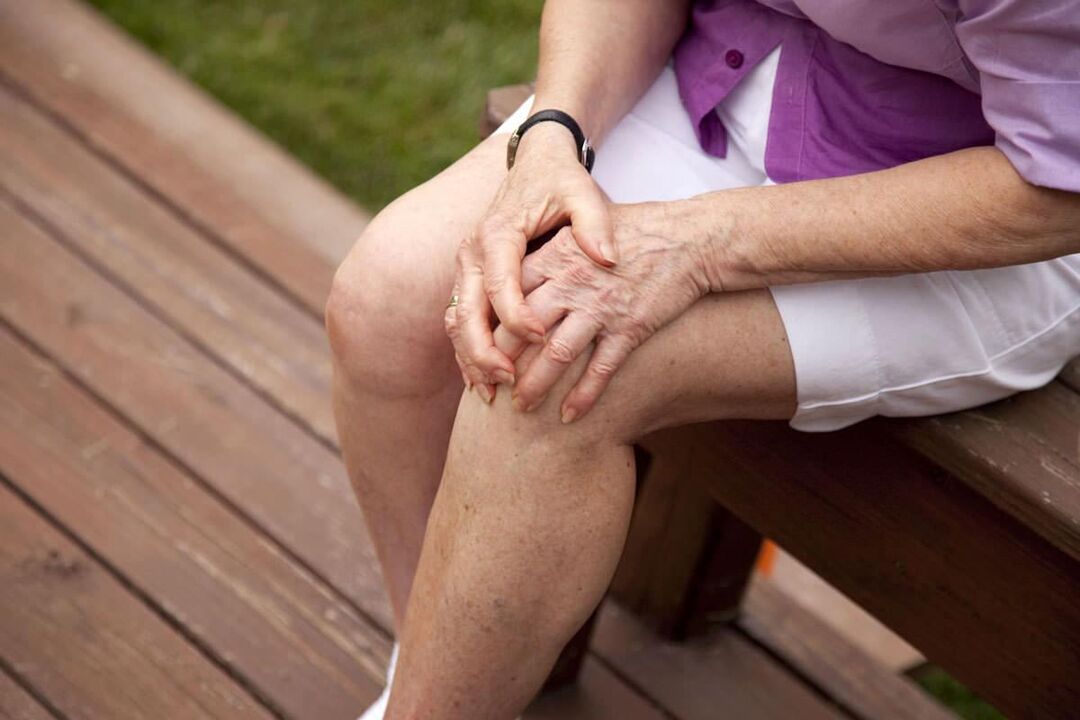 Osteoartróza kolene je běžná u starších žen